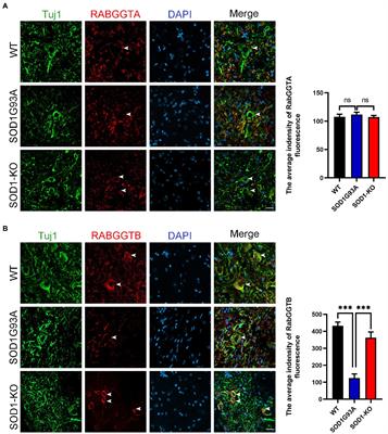 Protective effects of intrathecal injection of AAV9-RabGGTB-GFP+ in SOD1G93A mice